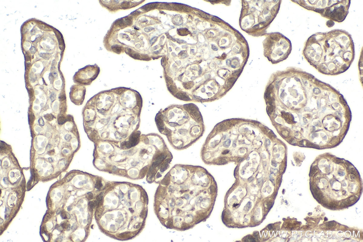 Immunohistochemical analysis of paraffin-embedded human placenta tissue slide using KHC2069 (MAPK13 IHC Kit).