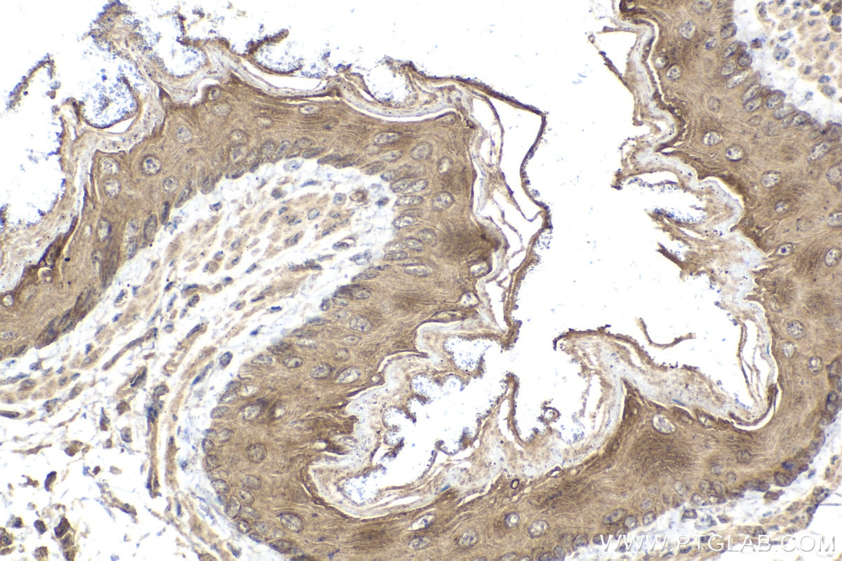 Immunohistochemical analysis of paraffin-embedded mouse esophagus tissue slide using KHC2069 (MAPK13 IHC Kit).