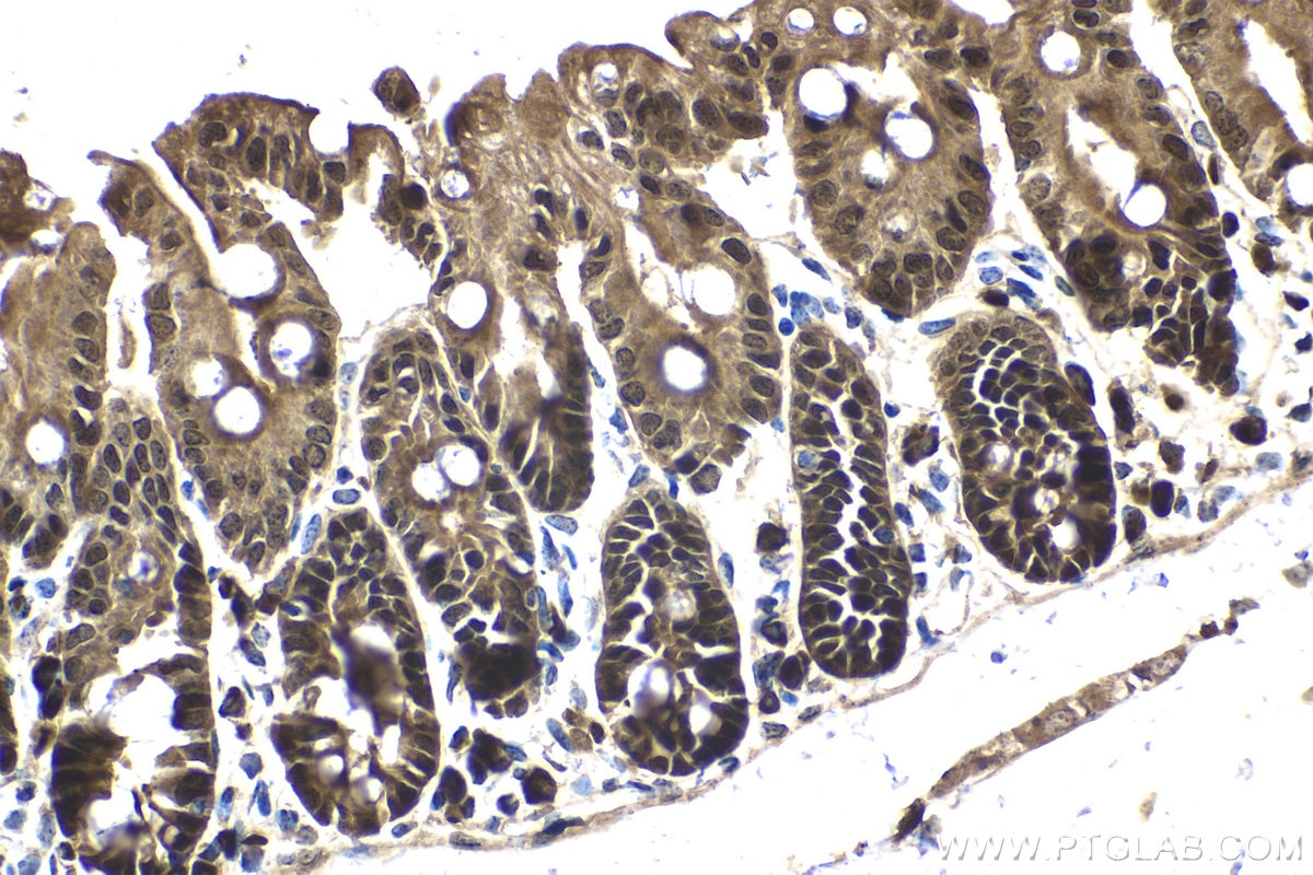 Immunohistochemical analysis of paraffin-embedded mouse small intestine tissue slide using KHC2069 (MAPK13 IHC Kit).