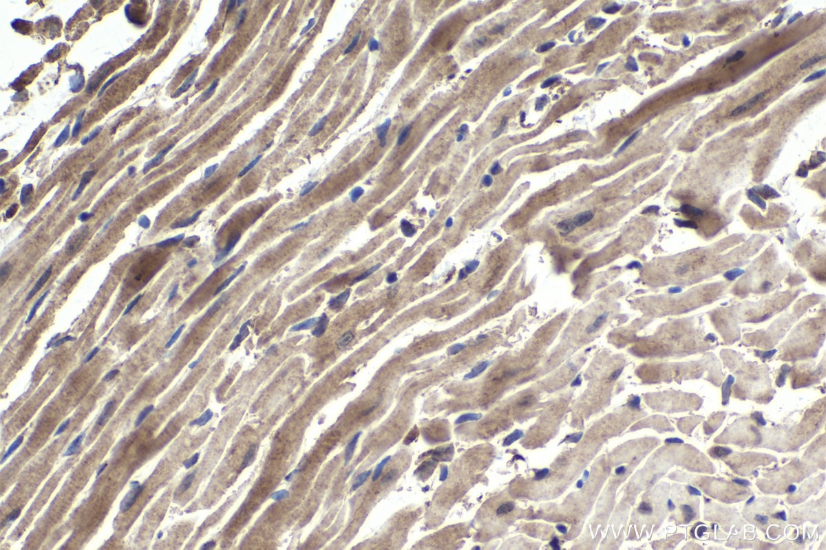 Immunohistochemical analysis of paraffin-embedded mouse heart tissue slide using KHC1704 (MAPK7 IHC Kit).