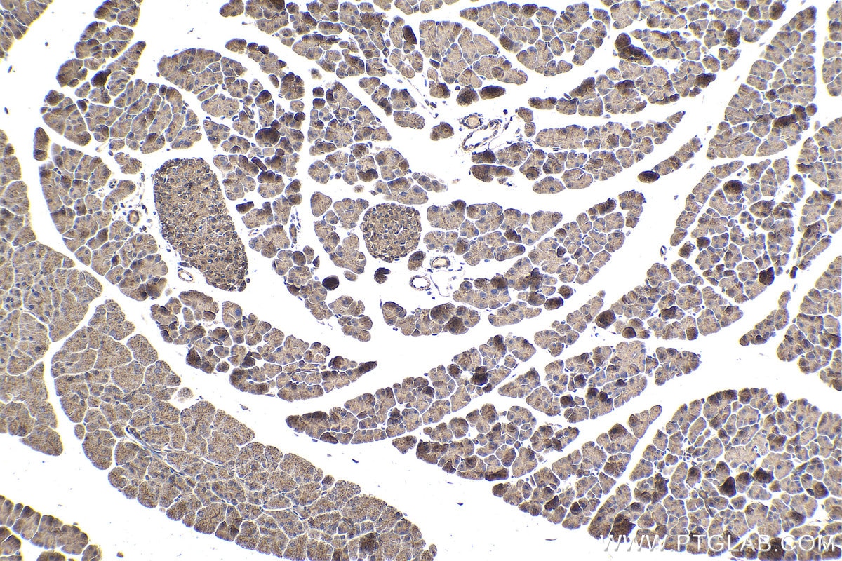 Immunohistochemical analysis of paraffin-embedded mouse pancreas tissue slide using KHC1704 (MAPK7 IHC Kit).