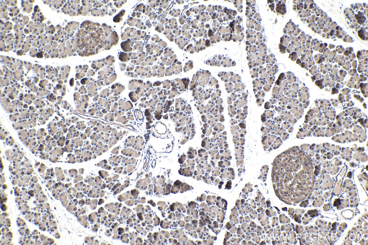 Immunohistochemical analysis of paraffin-embedded rat pancreas tissue slide using KHC1704 (MAPK7 IHC Kit).