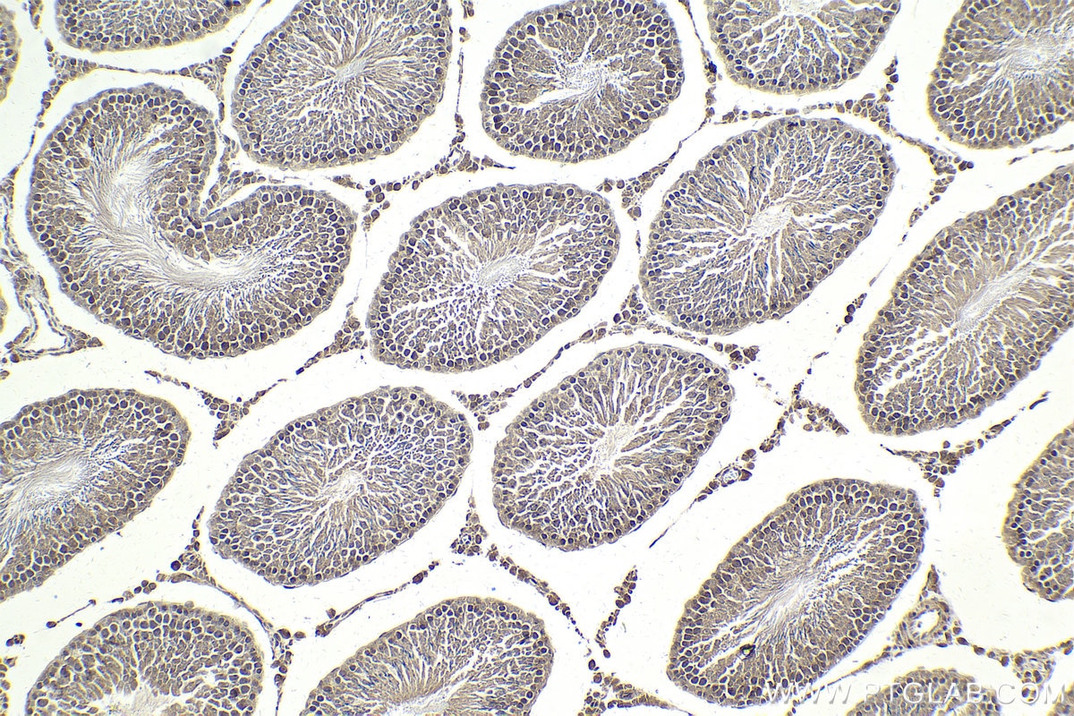 Immunohistochemical analysis of paraffin-embedded rat testis tissue slide using KHC2010 (MAPK8IP1/JIP1 IHC Kit).