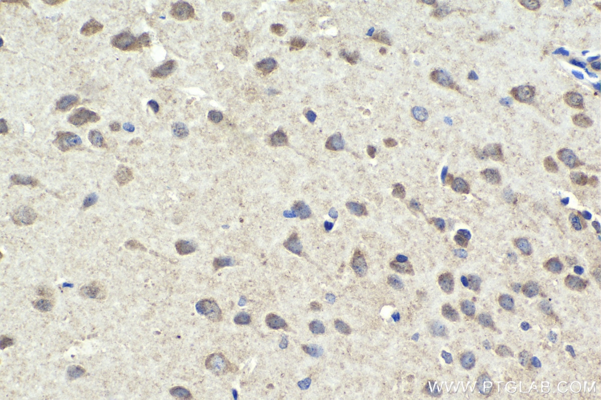 Immunohistochemical analysis of paraffin-embedded rat brain tissue slide using KHC2010 (MAPK8IP1/JIP1 IHC Kit).