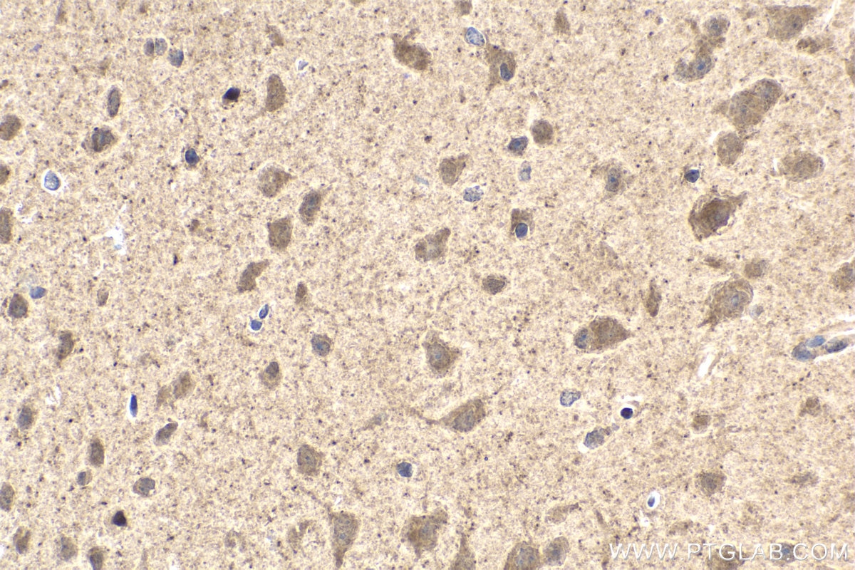 Immunohistochemical analysis of paraffin-embedded mouse brain tissue slide using KHC2010 (MAPK8IP1/JIP1 IHC Kit).