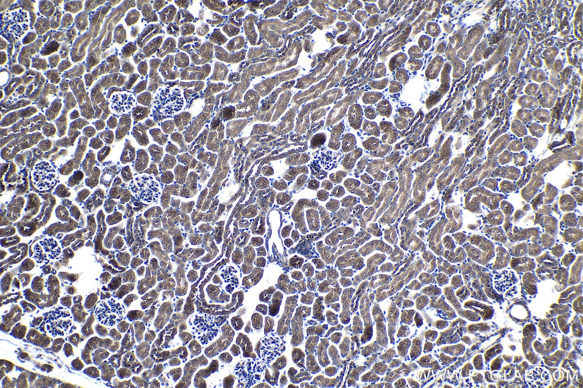 Immunohistochemical analysis of paraffin-embedded mouse kidney tissue slide using KHC1287 (MAPKBP1 IHC Kit).