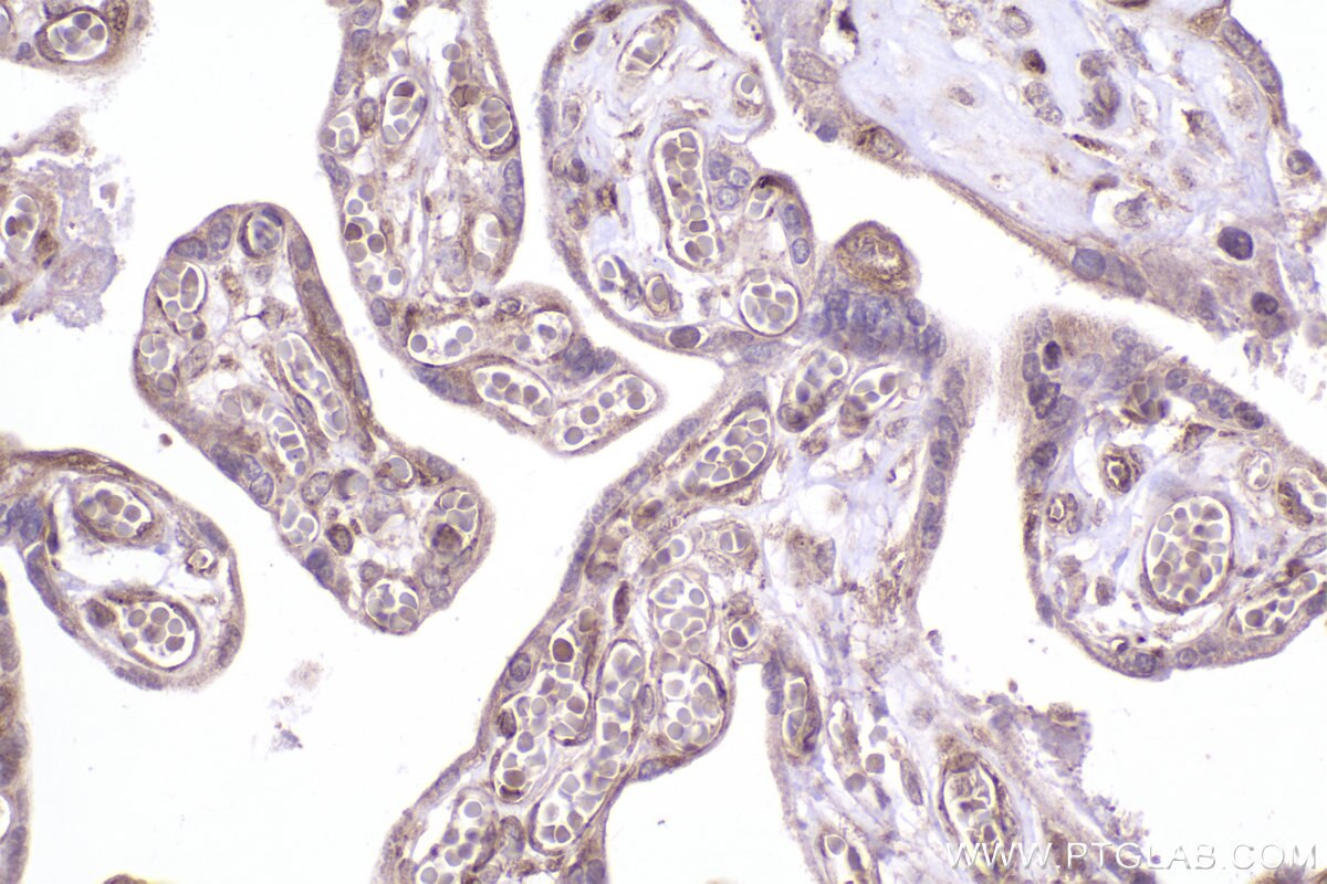 Immunohistochemical analysis of paraffin-embedded human placenta tissue slide using KHC2494 (MAPRE1/EB1 IHC Kit).