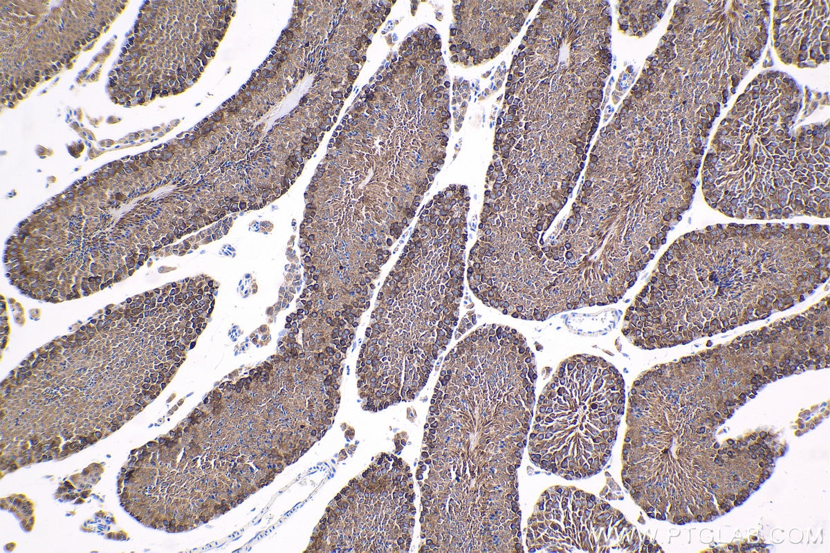 Immunohistochemical analysis of paraffin-embedded mouse testis tissue slide using KHC1631 (MARS1 IHC Kit).