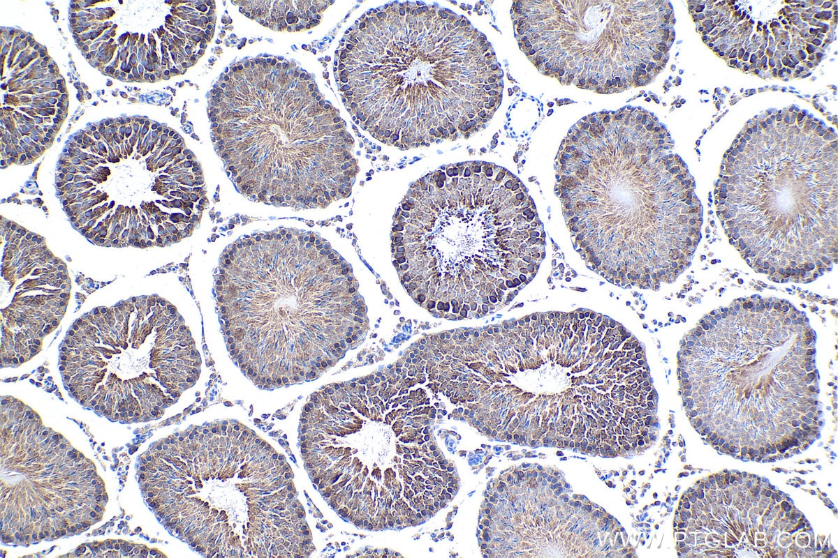 Immunohistochemical analysis of paraffin-embedded rat testis tissue slide using KHC1631 (MARS1 IHC Kit).