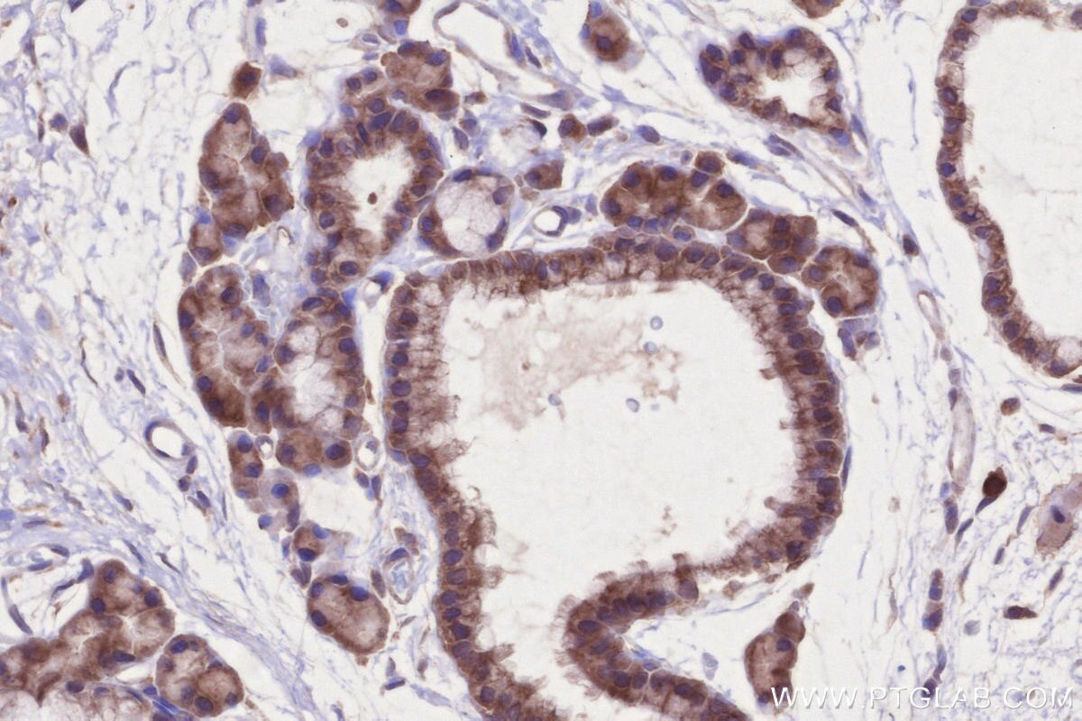 Immunohistochemical analysis of paraffin-embedded rat thyroid gland tissue slide using KHC2675 (MARVELD2 IHC Kit).