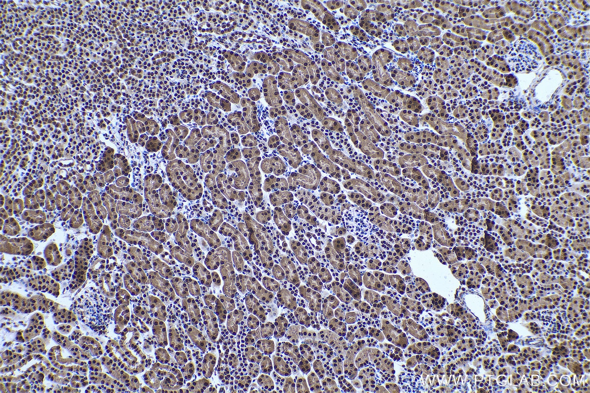 Immunohistochemical analysis of paraffin-embedded mouse kidney tissue slide using KHC0910 (MAT2A IHC Kit).