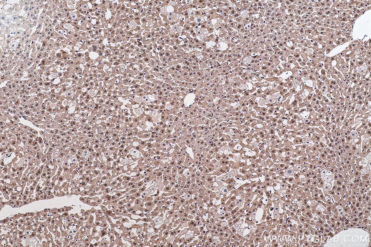 Immunohistochemical analysis of paraffin-embedded mouse liver tissue slide using KHC0910 (MAT2A IHC Kit).