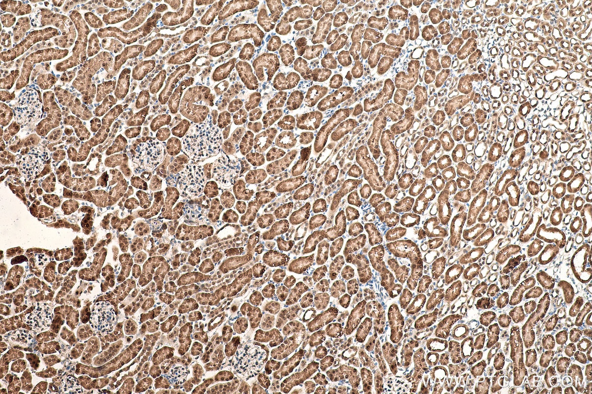 Immunohistochemical analysis of paraffin-embedded mouse kidney tissue slide using KHC0854 (MAT2B IHC Kit).