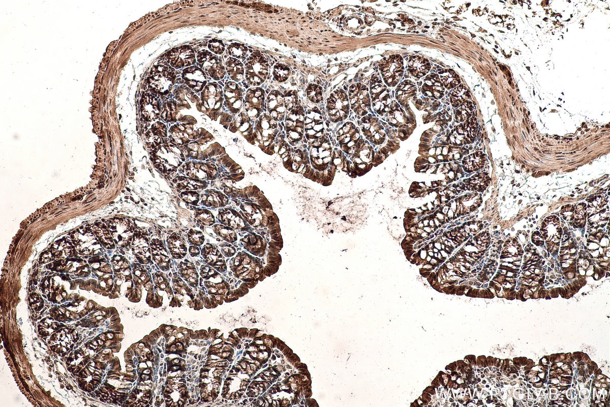 Immunohistochemical analysis of paraffin-embedded mouse colon tissue slide using KHC0854 (MAT2B IHC Kit).