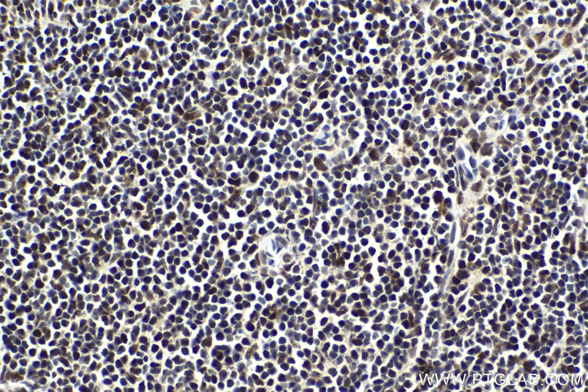 Immunohistochemical analysis of paraffin-embedded mouse spleen tissue slide using KHC1641 (MAX IHC Kit).