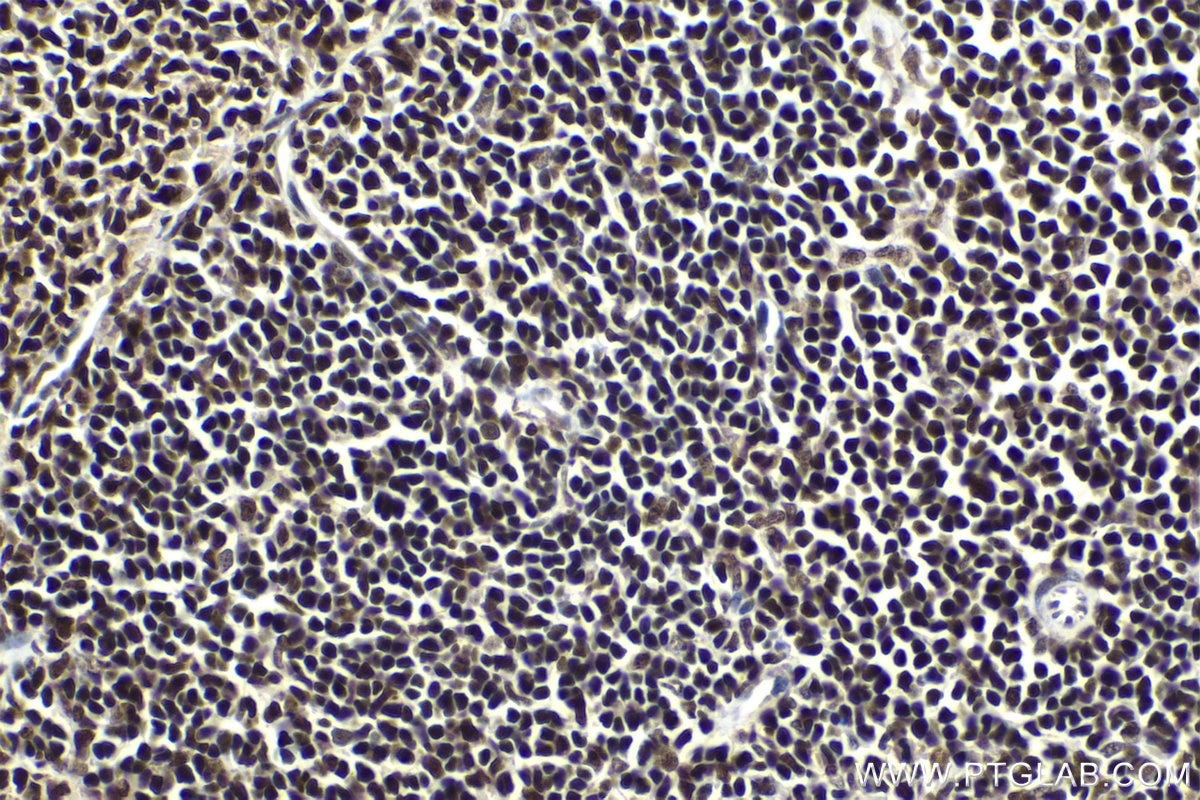 Immunohistochemical analysis of paraffin-embedded rat spleen tissue slide using KHC1641 (MAX IHC Kit).