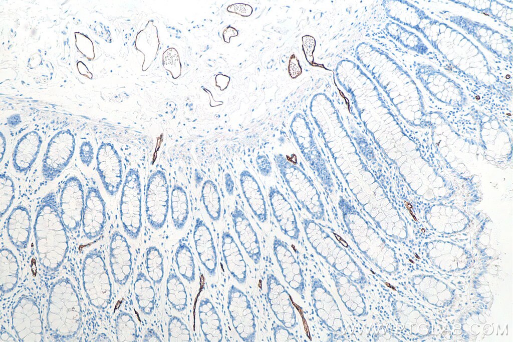 Immunohistochemical analysis of paraffin-embedded human colon tissue slide using KHC0025 (MAdCAM1 IHC Kit).