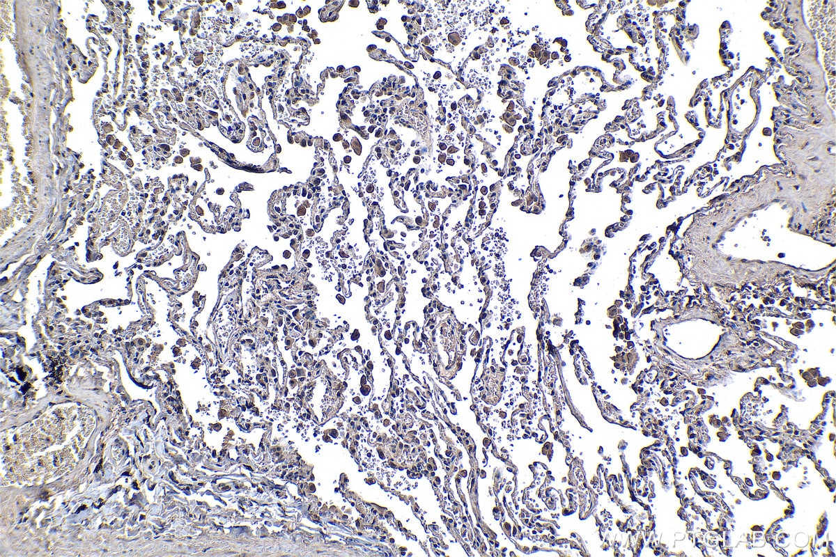Immunohistochemical analysis of paraffin-embedded human lung tissue slide using KHC1309 (MBIP IHC Kit).