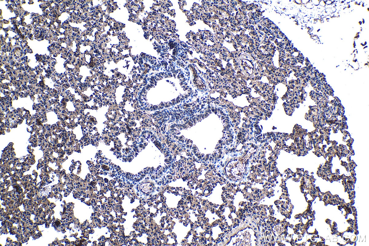 Immunohistochemical analysis of paraffin-embedded mouse lung tissue slide using KHC1309 (MBIP IHC Kit).