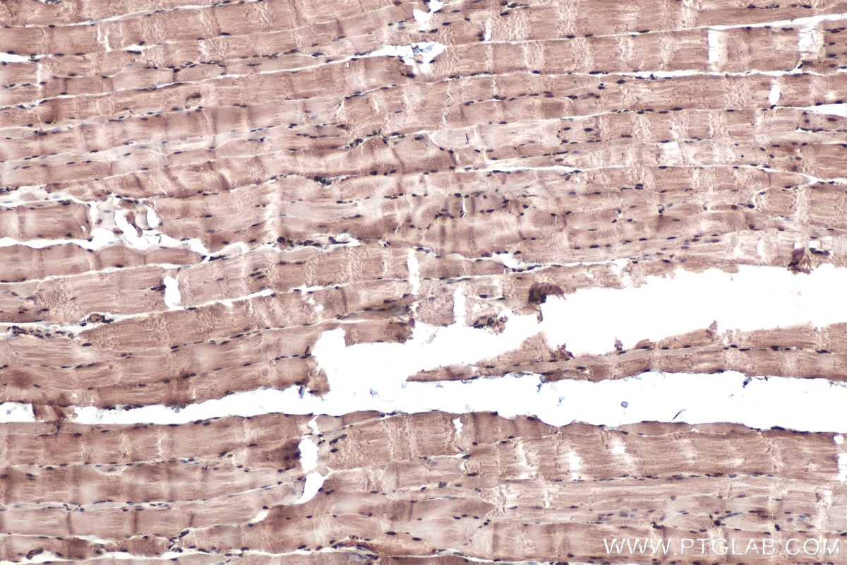 Immunohistochemical analysis of paraffin-embedded rat skeletal muscle tissue slide using KHC0433 (MBNL1 IHC Kit).