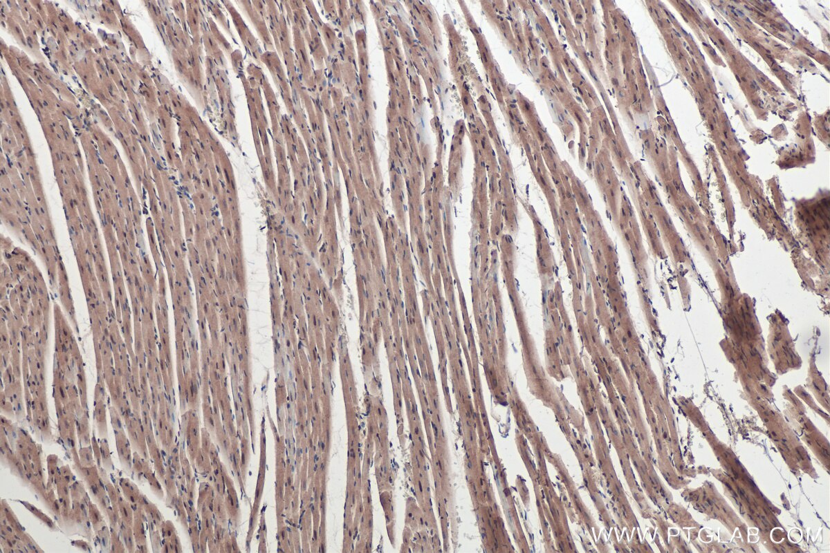 Immunohistochemical analysis of paraffin-embedded rat heart tissue slide using KHC0433 (MBNL1 IHC Kit).