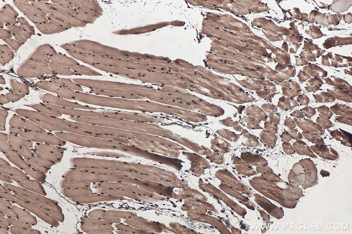 Immunohistochemical analysis of paraffin-embedded mouse skeletal muscle tissue slide using KHC0433 (MBNL1 IHC Kit).