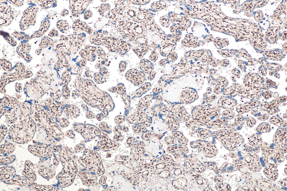 Immunohistochemical analysis of paraffin-embedded human placenta tissue slide using KHC0433 (MBNL1 IHC Kit).