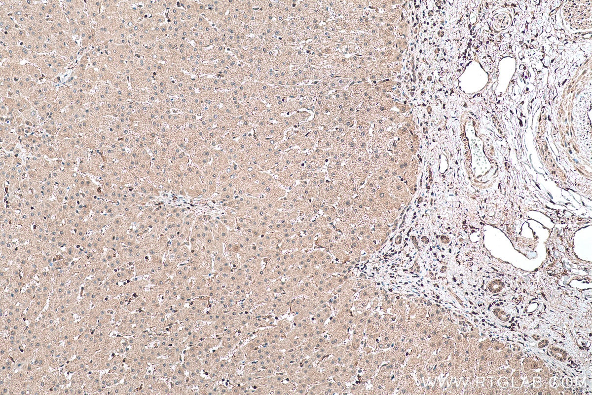 Immunohistochemical analysis of paraffin-embedded human liver tissue slide using KHC0433 (MBNL1 IHC Kit).