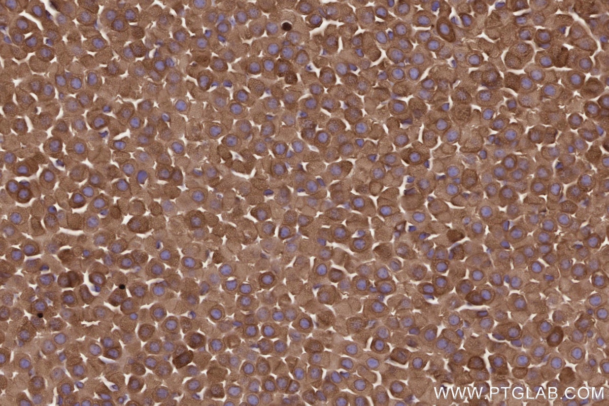 Immunohistochemical analysis of paraffin-embedded mouse adrenal gland tissue slide using KHC2808 (MBOAT7 IHC Kit).