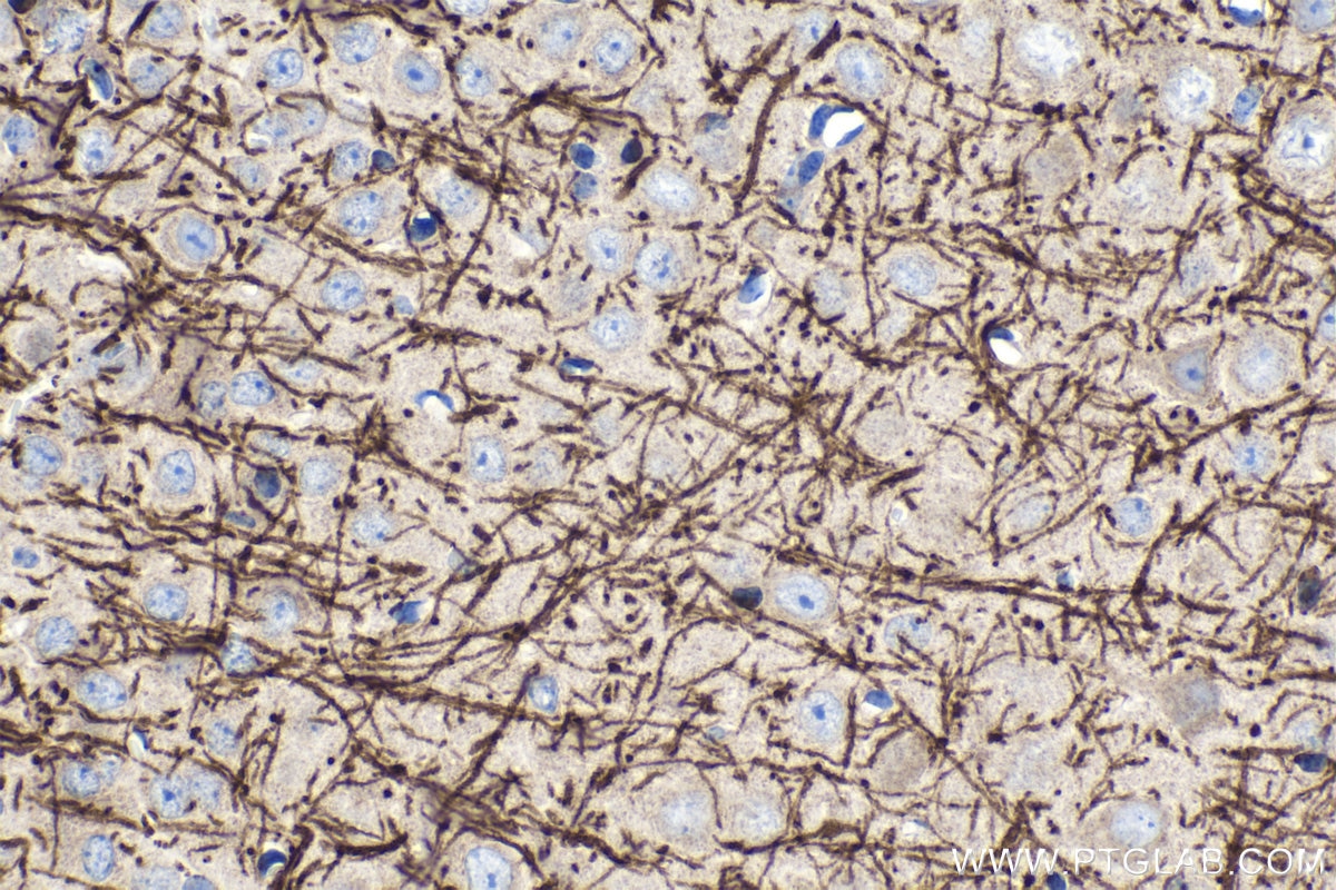 Immunohistochemical analysis of paraffin-embedded mouse brain tissue slide using KHC1504 (MBP IHC Kit).