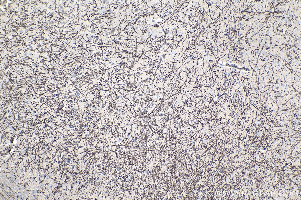 Immunohistochemical analysis of paraffin-embedded rat brain tissue slide using KHC1504 (MBP IHC Kit).