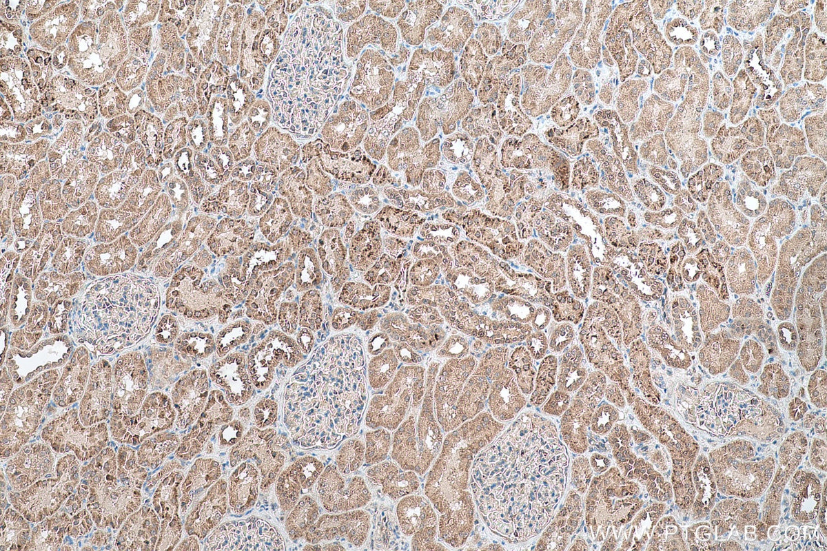 Immunohistochemical analysis of paraffin-embedded human kidney tissue slide using KHC0759 (MCC IHC Kit).