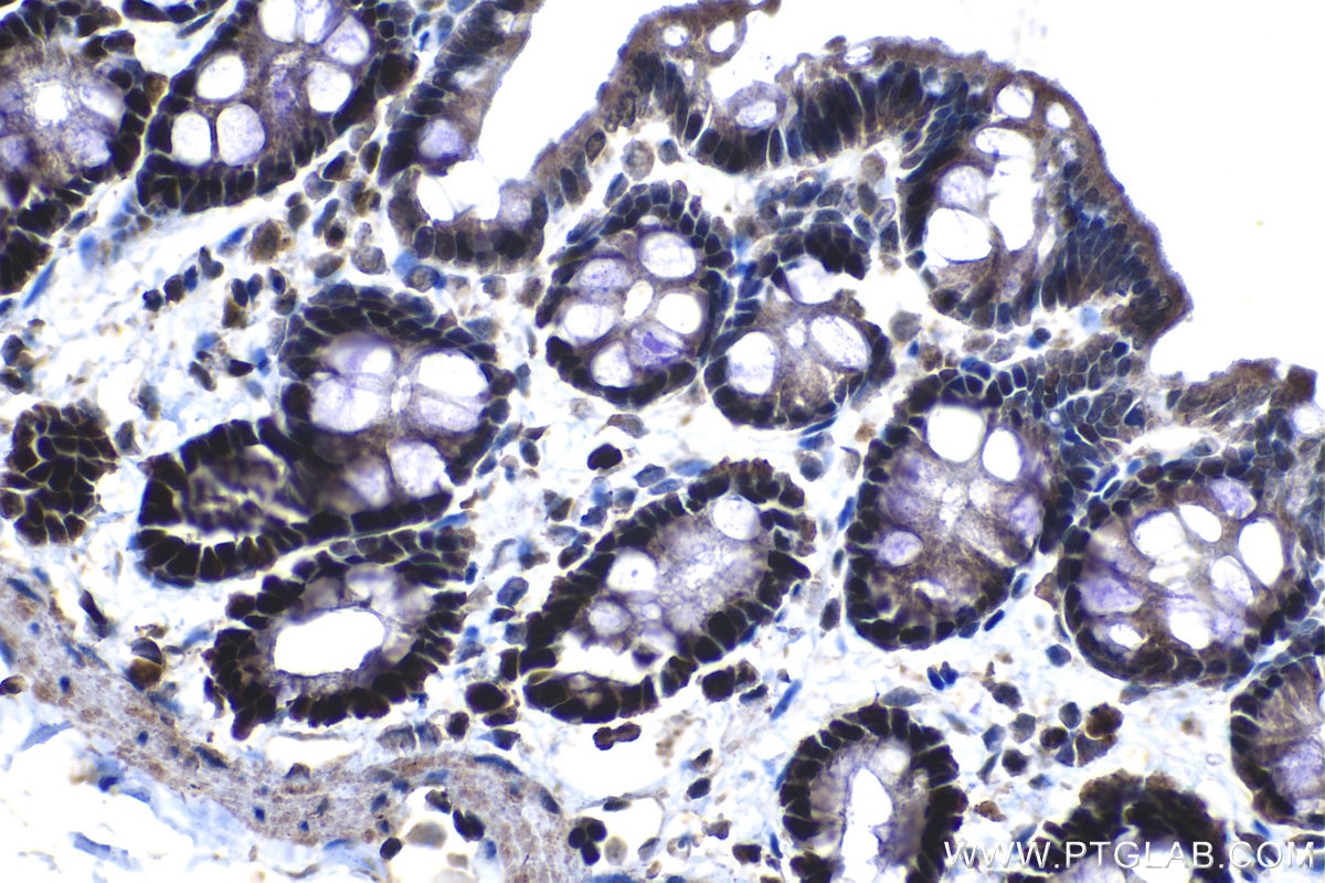 Immunohistochemical analysis of paraffin-embedded rat colon tissue slide using KHC1209 (MCM2 IHC Kit).