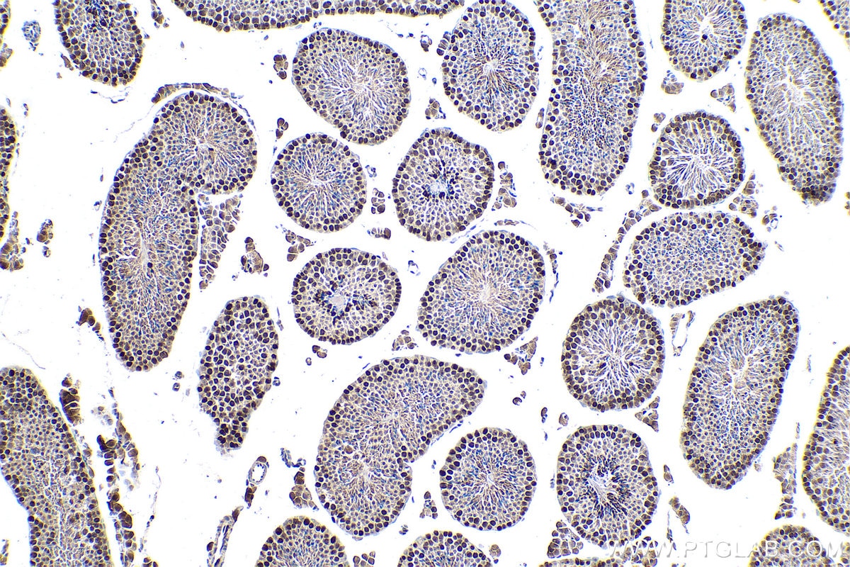 Immunohistochemical analysis of paraffin-embedded mouse testis tissue slide using KHC0915 (MCM3 IHC Kit).