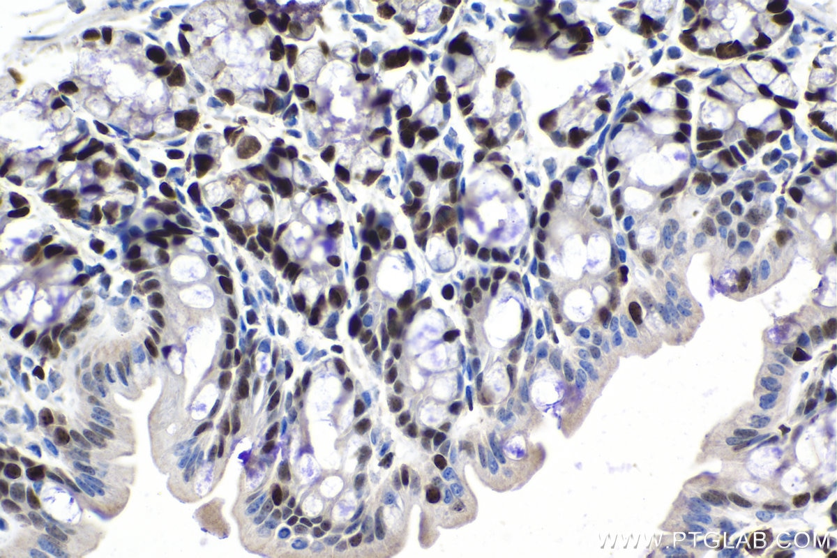 Immunohistochemical analysis of paraffin-embedded mouse colon tissue slide using KHC1028 (MCM4 IHC Kit).