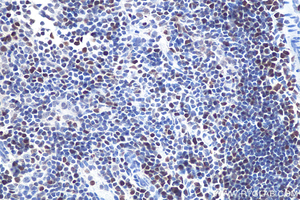 Immunohistochemical analysis of paraffin-embedded mouse thymus tissue slide using KHC1029 (MCM5 IHC Kit).