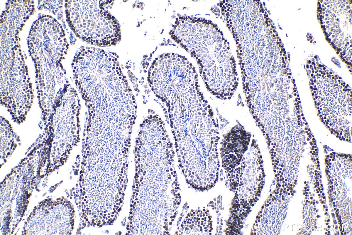 Immunohistochemical analysis of paraffin-embedded mouse testis tissue slide using KHC1029 (MCM5 IHC Kit).