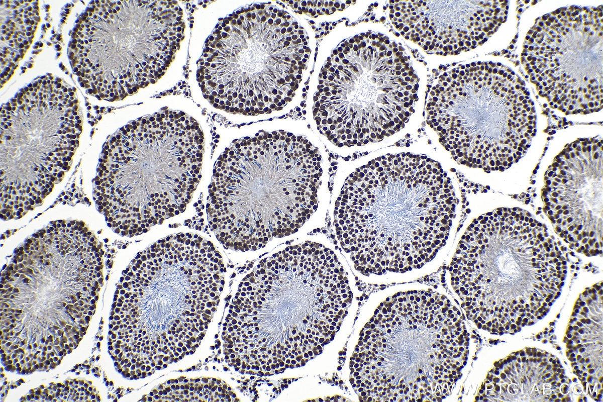 Immunohistochemical analysis of paraffin-embedded rat testis tissue slide using KHC1325 (MCM6 IHC Kit).