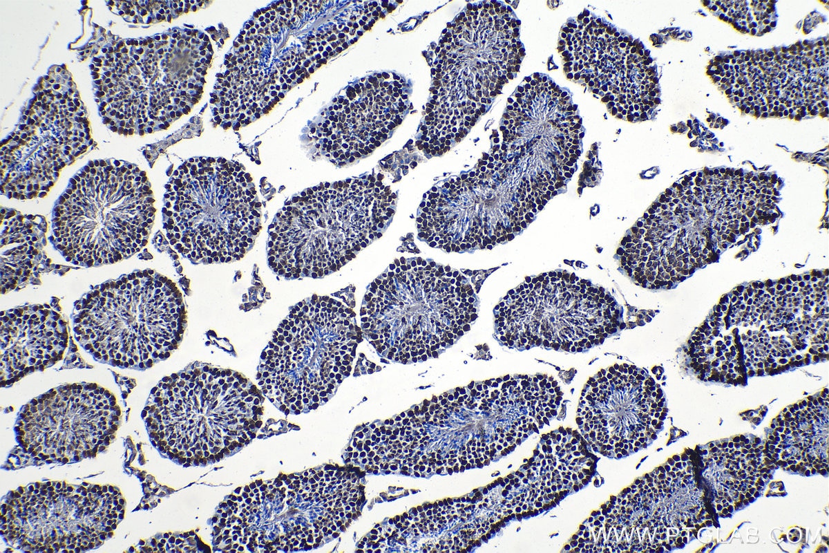 Immunohistochemical analysis of paraffin-embedded mouse testis tissue slide using KHC1324 (MCM7 IHC Kit).