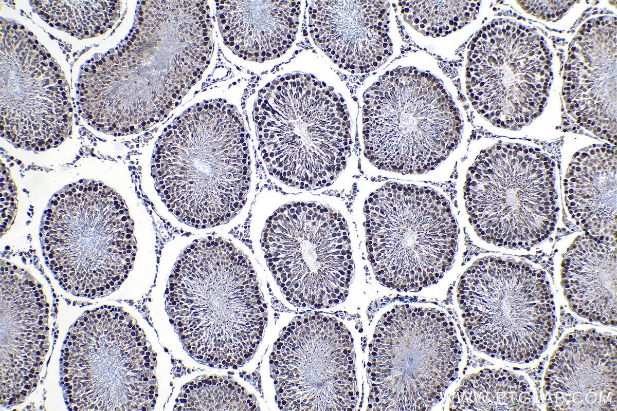 Immunohistochemical analysis of paraffin-embedded rat testis tissue slide using KHC1324 (MCM7 IHC Kit).