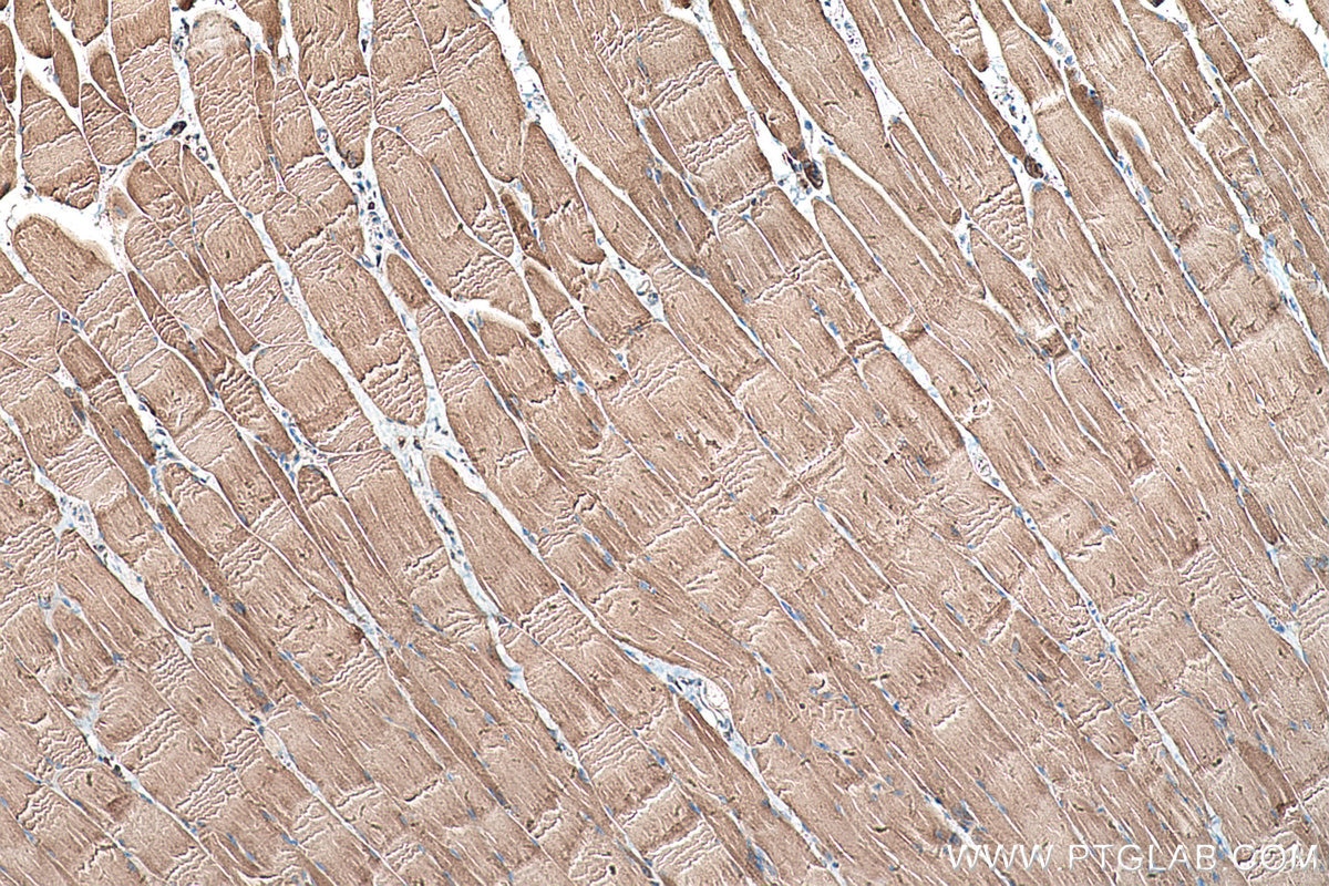 Immunohistochemical analysis of paraffin-embedded rat skeletal muscle tissue slide using KHC0524 (MDH2 IHC Kit).