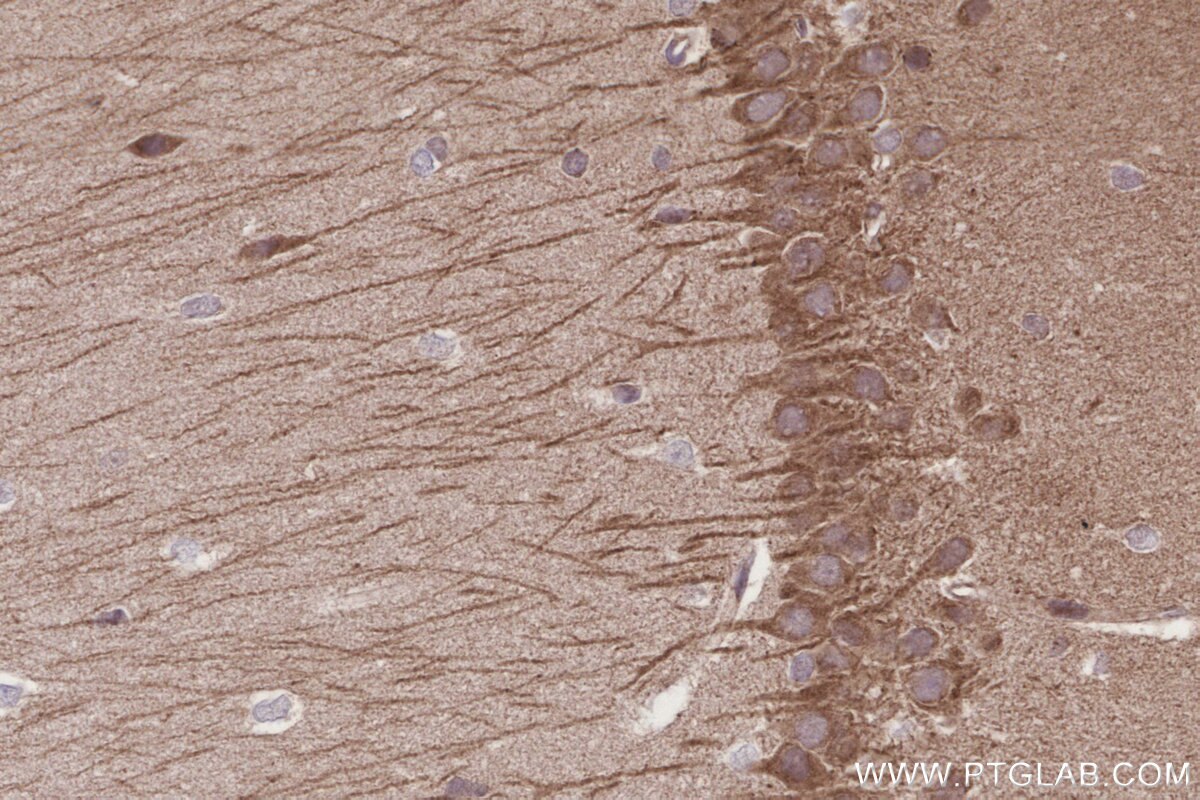 Immunohistochemical analysis of paraffin-embedded rat brain tissue slide using KHC3199 (ME2 IHC Kit).