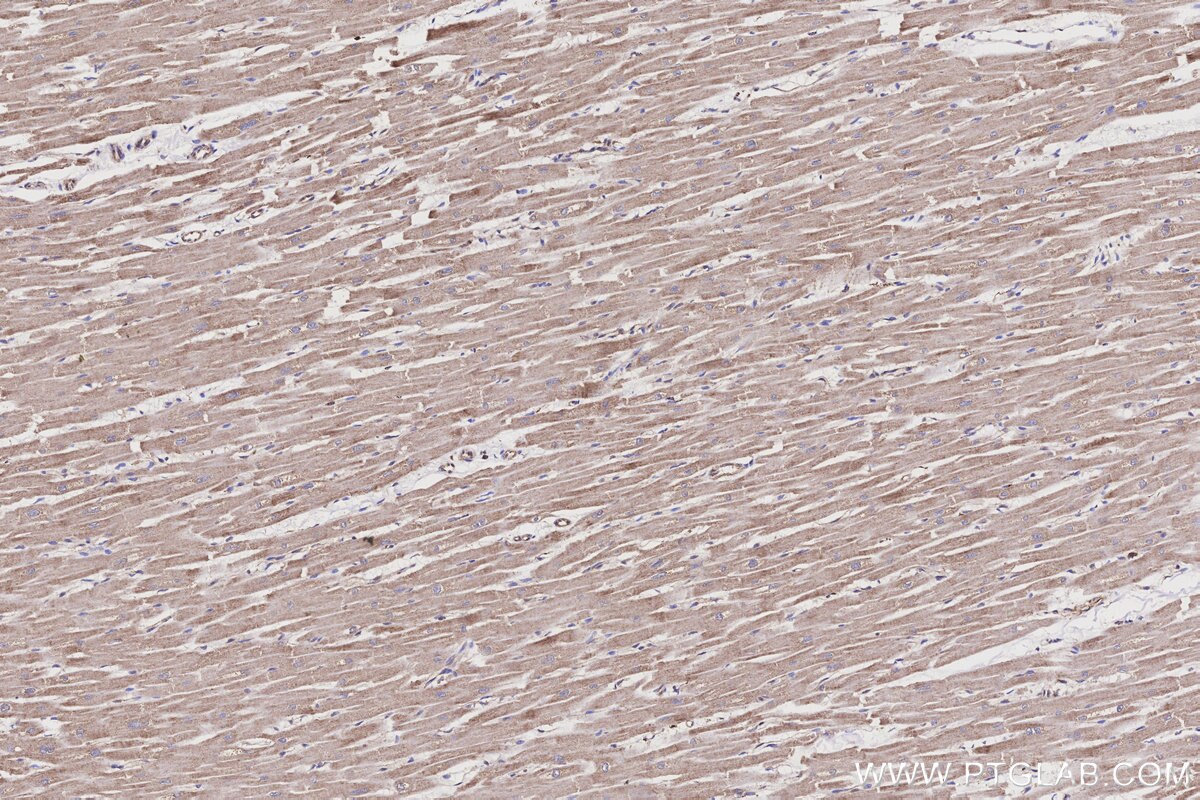 Immunohistochemical analysis of paraffin-embedded human heart tissue slide using KHC3199 (ME2 IHC Kit).