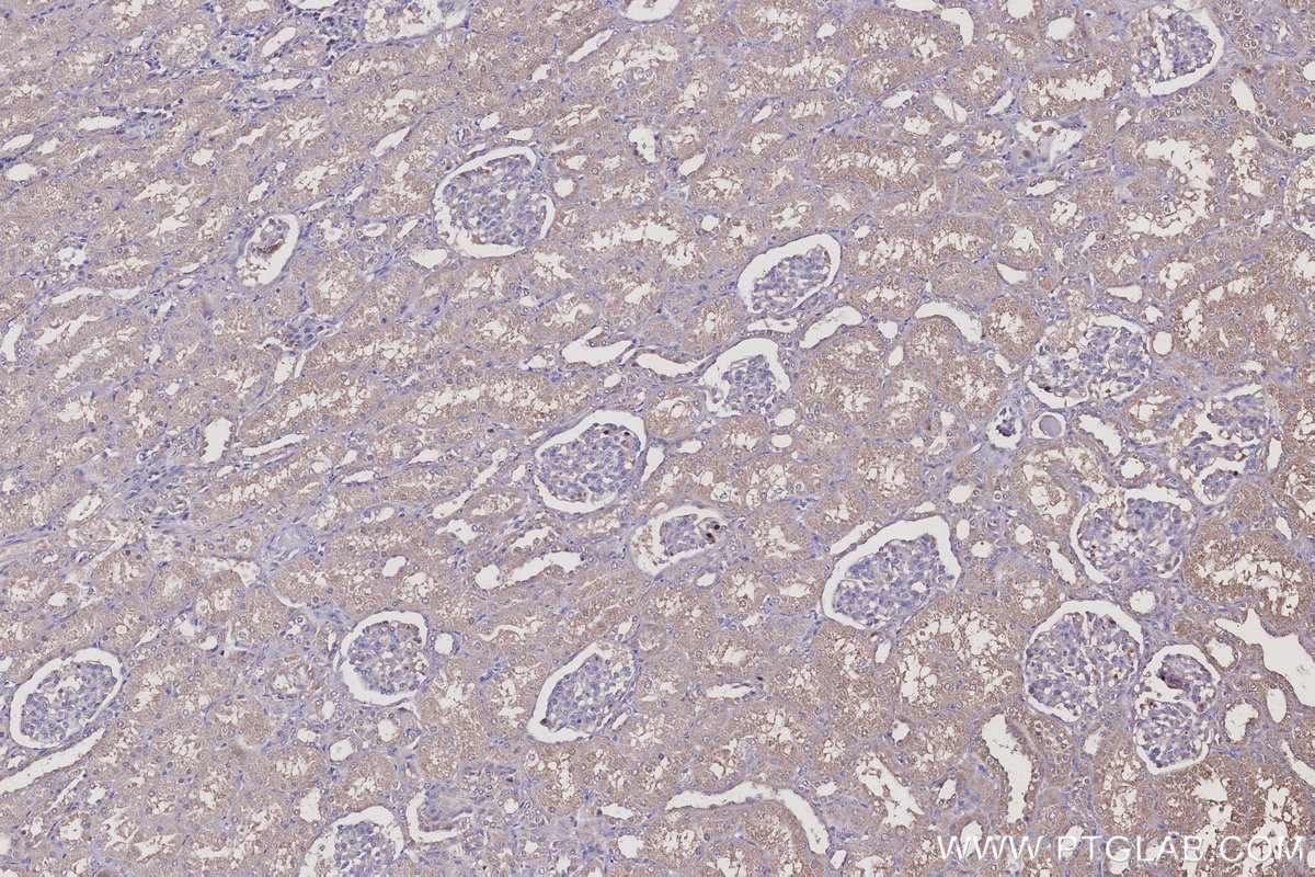 Immunohistochemical analysis of paraffin-embedded human kidney tissue slide using KHC3125 (MEA1 IHC Kit).