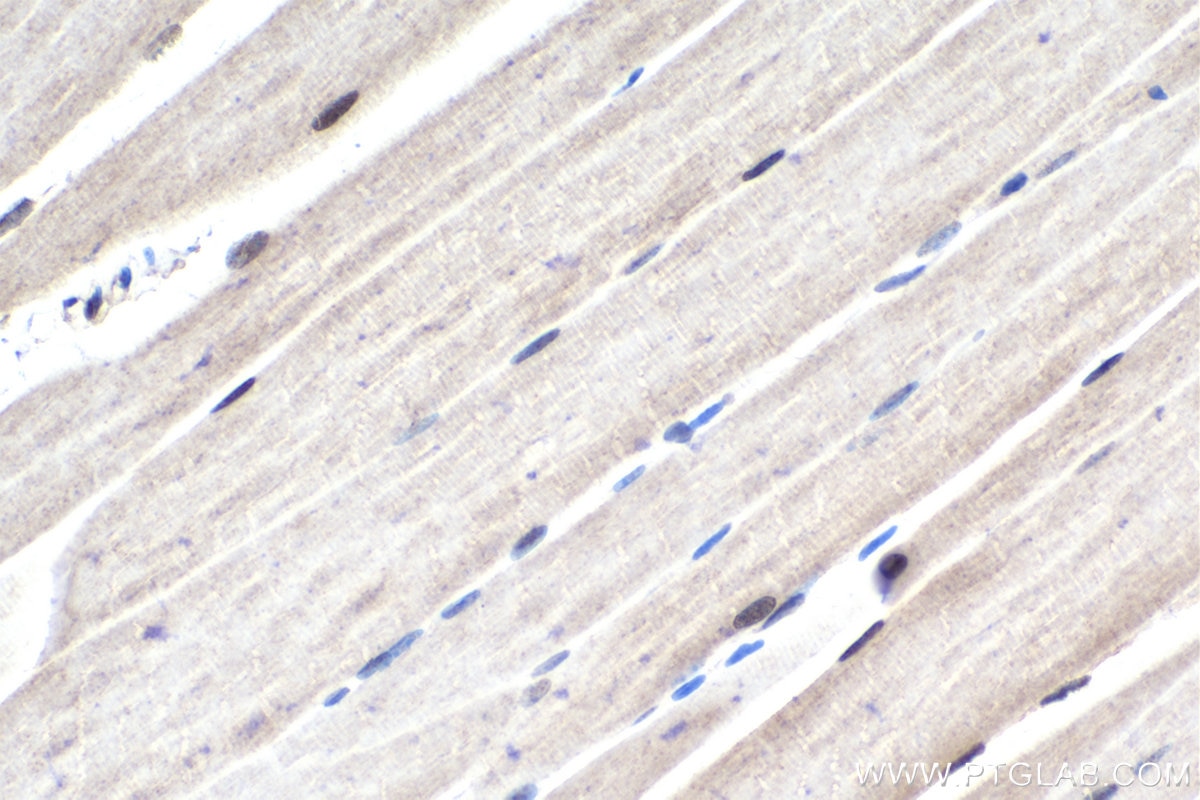 Immunohistochemical analysis of paraffin-embedded mouse skeletal muscle tissue slide using KHC1680 (MEF2C IHC Kit).