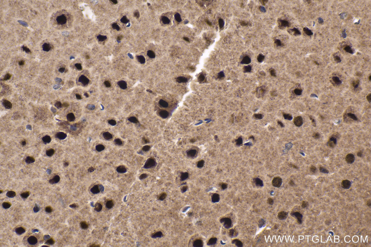 Immunohistochemical analysis of paraffin-embedded mouse brain tissue slide using KHC1680 (MEF2C IHC Kit).