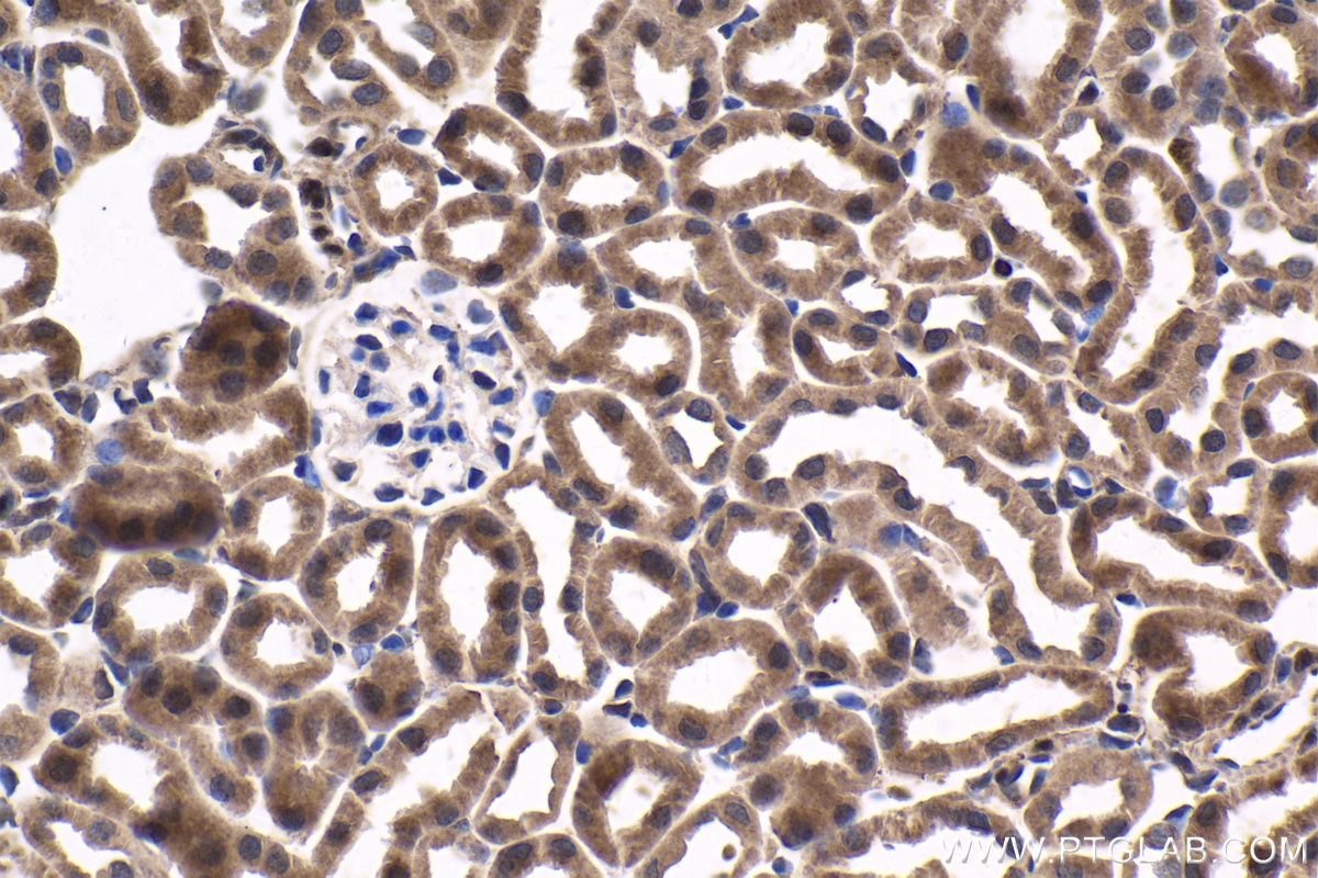 Immunohistochemical analysis of paraffin-embedded mouse kidney tissue slide using KHC1680 (MEF2C IHC Kit).