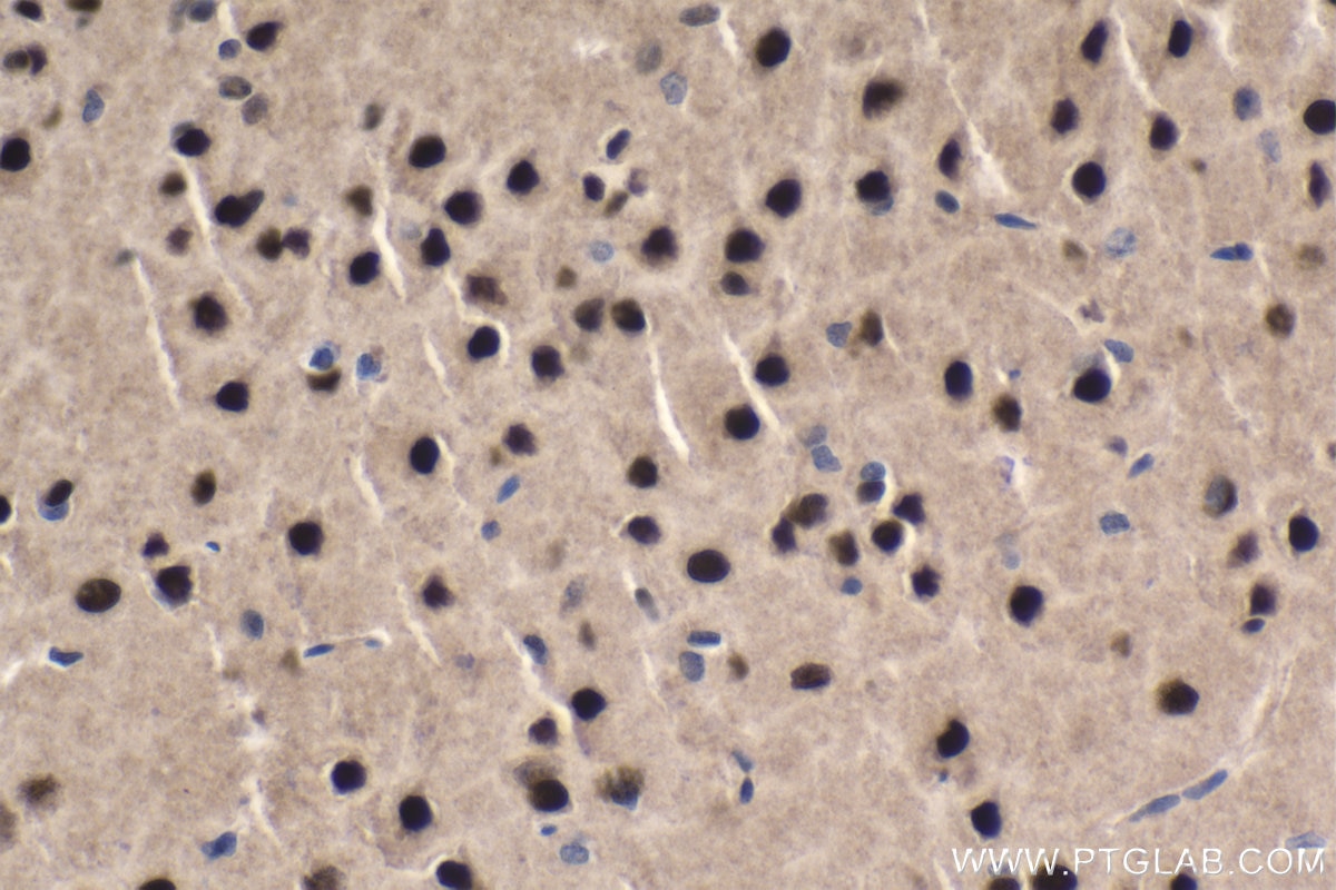Immunohistochemical analysis of paraffin-embedded rat brain tissue slide using KHC1680 (MEF2C IHC Kit).