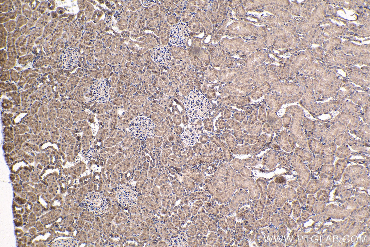 Immunohistochemical analysis of paraffin-embedded rat kidney tissue slide using KHC1680 (MEF2C IHC Kit).