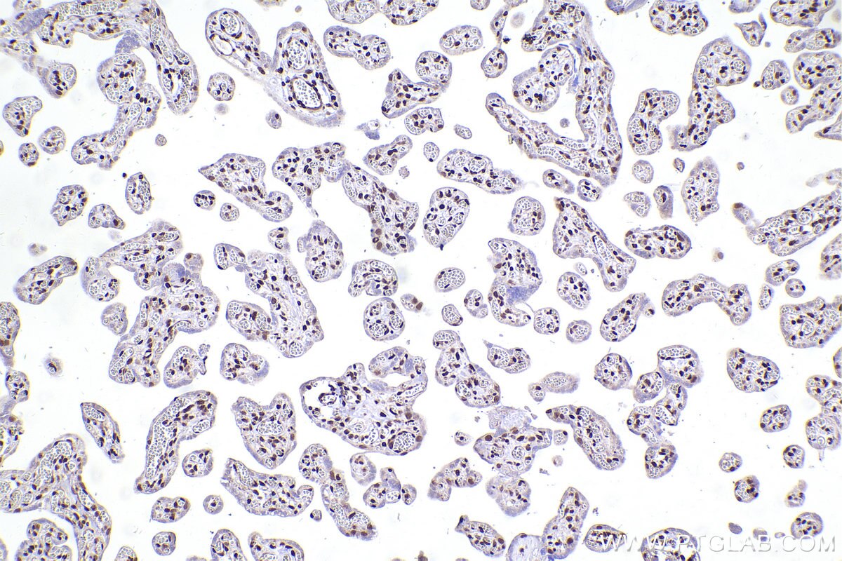 Immunohistochemical analysis of paraffin-embedded human placenta tissue slide using KHC2469 (MEF2D IHC Kit).